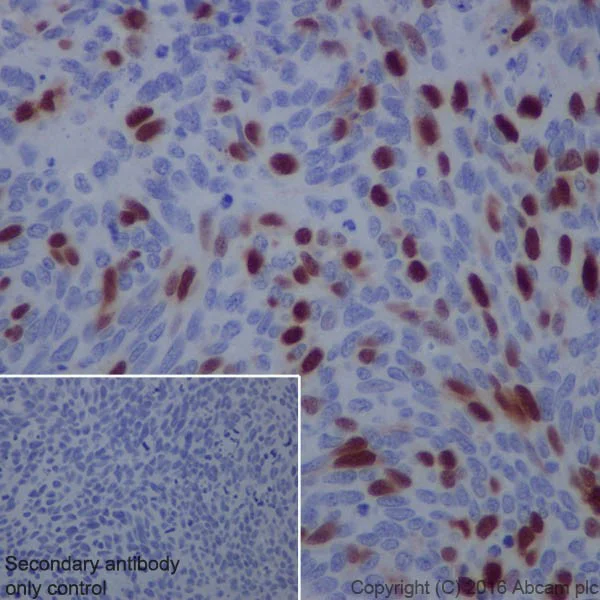 Immunohistochemistry (Formalin/PFA-fixed paraffin-embedded sections) - Anti-Cyclin A2 antibody [EPRR19346-64] - BSA and Azide free (AB251532)