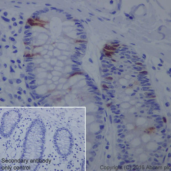 Immunohistochemistry (Formalin/PFA-fixed paraffin-embedded sections) - Anti-Cyclin A2 antibody [EPRR19346-64] - BSA and Azide free (AB251532)