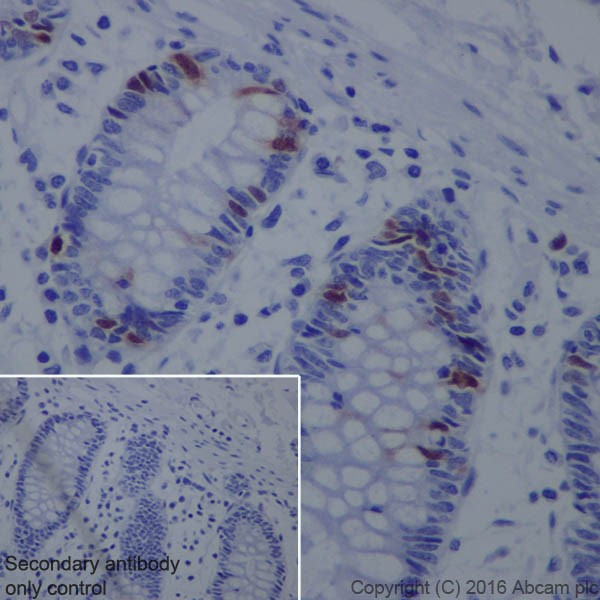 Immunohistochemistry (Formalin/PFA-fixed paraffin-embedded sections) - Anti-Cyclin A2 antibody [EPRR19346] (ab211736), expandable thumbnail