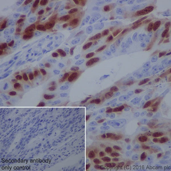 Immunohistochemistry (Formalin/PFA-fixed paraffin-embedded sections) - Anti-Cyclin A2 antibody [EPRR19346] (AB211736), expandable thumbnail