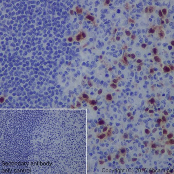 Immunohistochemistry (Formalin/PFA-fixed paraffin-embedded sections) - Anti-Cyclin A2 antibody [EPRR19346] (ab211736), expandable thumbnail