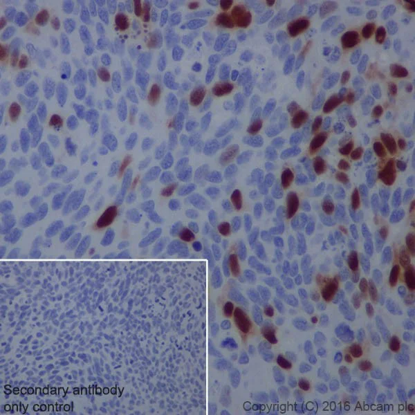 Immunohistochemistry (Formalin/PFA-fixed paraffin-embedded sections) - Anti-Cyclin A2 antibody [EPRR19346] - BSA and Azide free (AB251533)