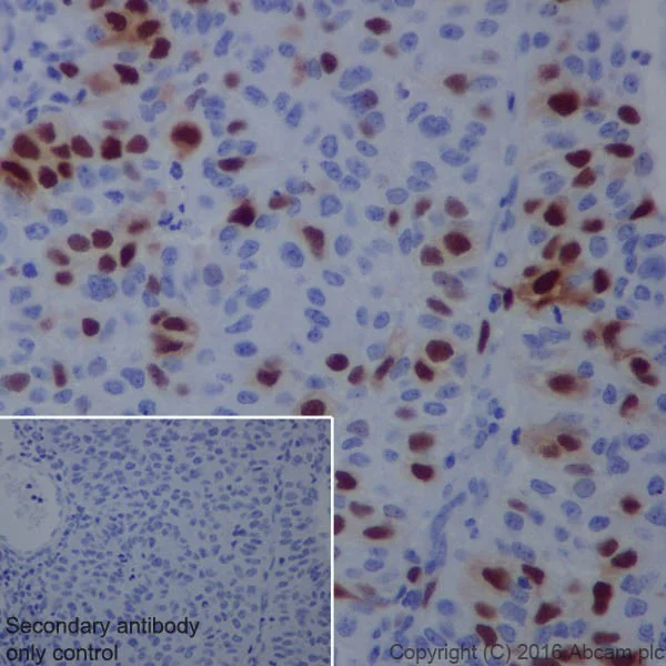 Immunohistochemistry (Formalin/PFA-fixed paraffin-embedded sections) - Anti-Cyclin A2 antibody [EPRR19346] - BSA and Azide free (AB251533)