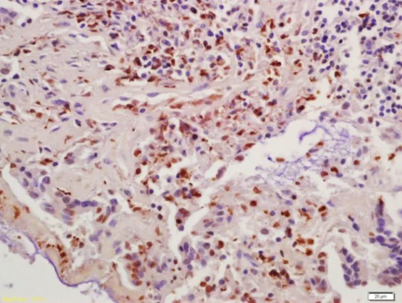 Immunohistochemistry (Formalin/PFA-fixed paraffin-embedded sections) - Anti-Cyclin B1 antibody (AB215436)