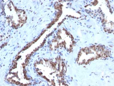 Immunohistochemistry (Formalin/PFA-fixed paraffin-embedded sections) - Anti-Cyclin B1 antibody [CCNB1/1098] (AB212977)