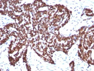 Immunohistochemistry (Formalin/PFA-fixed paraffin-embedded sections) - Anti-Cyclin B1 antibody [CCNB1/1098] (AB212977)