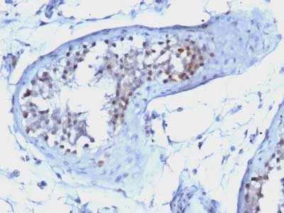 Immunohistochemistry (Formalin/PFA-fixed paraffin-embedded sections) - Anti-Cyclin B1 antibody [CCNB1/1098] (AB212977)