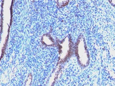 Immunohistochemistry (Formalin/PFA-fixed paraffin-embedded sections) - Anti-Cyclin B1 antibody [CCNB1/1098] (AB212977)