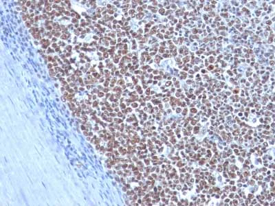 Immunohistochemistry (Formalin/PFA-fixed paraffin-embedded sections) - Anti-Cyclin B1 antibody [CCNB1/1098] (AB212977)