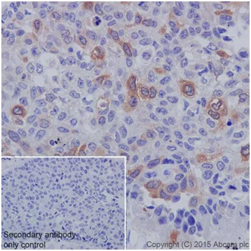 Immunohistochemistry (Formalin/PFA-fixed paraffin-embedded sections) - Anti-Cyclin B1 antibody [EPR17060] (AB181593)