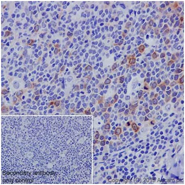 Immunohistochemistry (Formalin/PFA-fixed paraffin-embedded sections) - Anti-Cyclin B1 antibody [EPR17060] (AB181593)