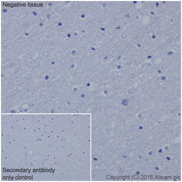 Immunohistochemistry (Formalin/PFA-fixed paraffin-embedded sections) - Anti-Cyclin B1 antibody [EPR17060] (AB181593)