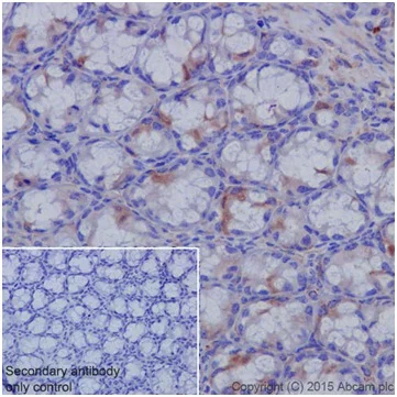 Immunohistochemistry (Formalin/PFA-fixed paraffin-embedded sections) - Anti-Cyclin B1 antibody [EPR17060] (AB181593)