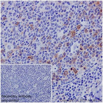 Immunohistochemistry (Formalin/PFA-fixed paraffin-embedded sections) - Anti-Cyclin B1 antibody [EPR17060] - BSA and Azide free (AB227844)