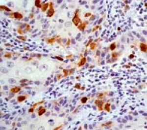 Immunohistochemistry (Formalin/PFA-fixed paraffin-embedded sections) - Anti-Cyclin B1 antibody [Y106] - BSA and Azide free (AB156447)