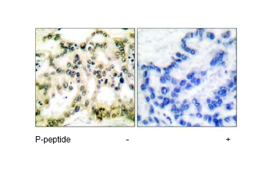 Immunohistochemistry (Formalin/PFA-fixed paraffin-embedded sections) - Anti-Cyclin B1 (phospho S126) antibody (AB55184)