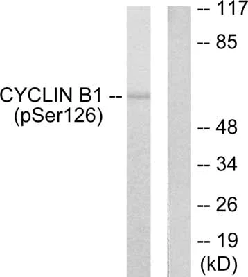 Western blot - Anti-Cyclin B1 (phospho S126) antibody (AB55184)