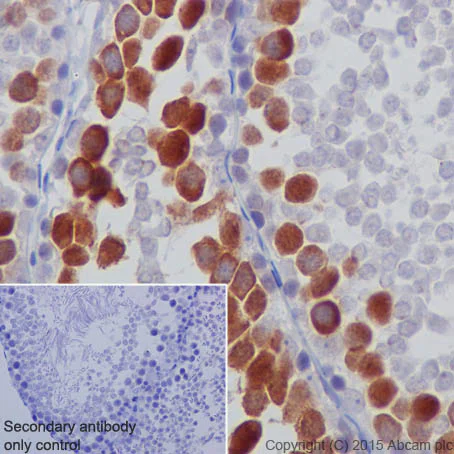 Immunohistochemistry (Formalin/PFA-fixed paraffin-embedded sections) - Anti-Cyclin B2/CCNB2 antibody [R17985] (AB185622)