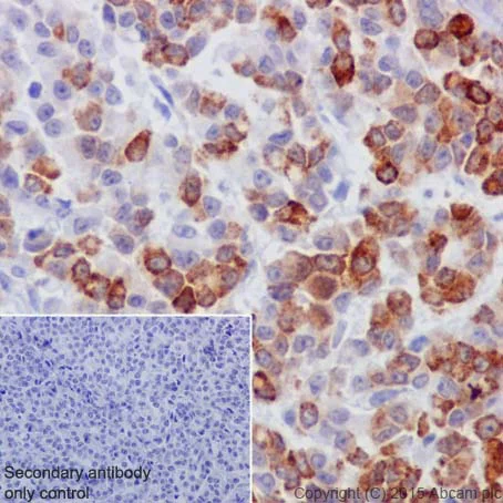Immunohistochemistry (Formalin/PFA-fixed paraffin-embedded sections) - Anti-Cyclin B2/CCNB2 antibody [R17985] (AB185622)