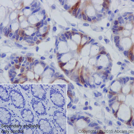 Immunohistochemistry (Formalin/PFA-fixed paraffin-embedded sections) - Anti-Cyclin B2/CCNB2 antibody [R17985] - BSA and Azide free (AB250841)