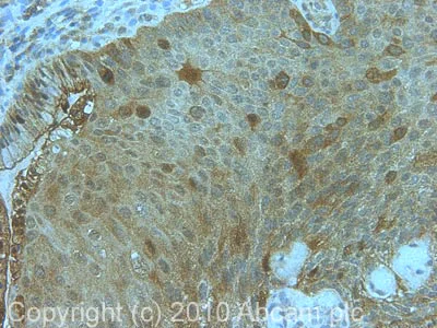 Immunohistochemistry (Formalin/PFA-fixed paraffin-embedded sections) - Anti-Cyclin B2/CCNB2 antibody [X29.2] (AB18250)