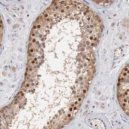 Immunohistochemistry (Formalin/PFA-fixed paraffin-embedded sections) - Anti-Cyclin B3 antibody (AB223715)