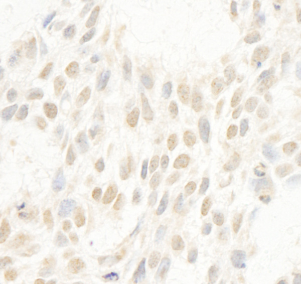 Immunohistochemistry (Formalin/PFA-fixed paraffin-embedded sections) - Anti-Cyclin C antibody (AB85927)