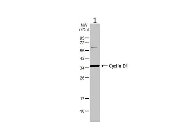 Anti-Cyclin D1 antibody. Rabbit polyclonal (ab226977) | Abcam