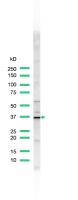 Western blot - Anti-Cyclin D1 antibody - C-terminal (AB185241)