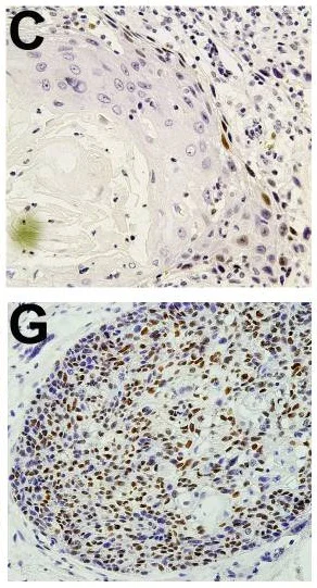 Immunohistochemistry (Formalin/PFA-fixed paraffin-embedded sections) - Anti-Cyclin D1 antibody [EPR2241] - BSA and Azide free (AB156448)