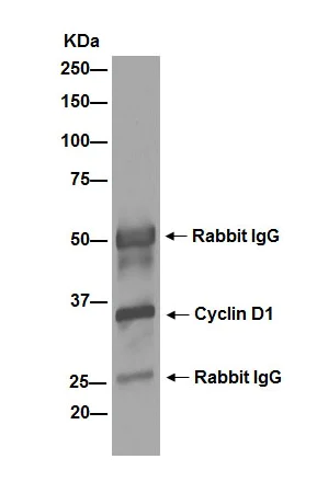 Immunoprecipitation - Anti-Cyclin D1 antibody [EPR2241] - BSA and Azide free (AB156448)