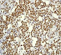 Immunohistochemistry (Formalin/PFA-fixed paraffin-embedded sections) - Anti-Cyclin D1 antibody [EPR2241] - C-terminal (AB134175)