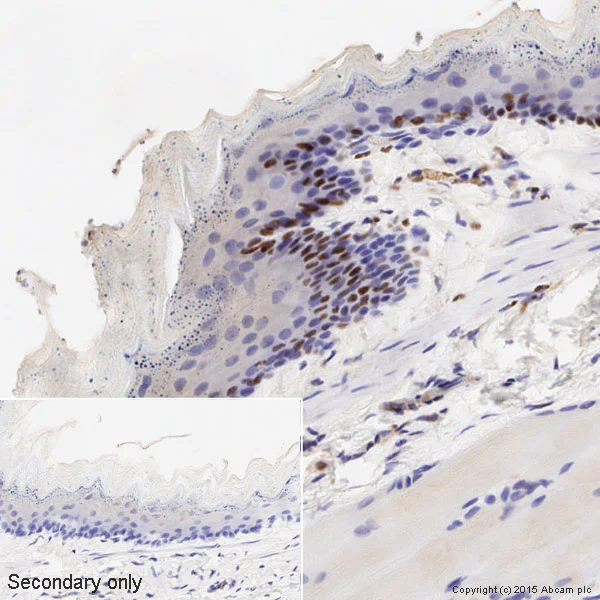 Immunohistochemistry (Formalin/PFA-fixed paraffin-embedded sections) - Anti-Cyclin D1 antibody [EPR2241] - C-terminal (AB134175)