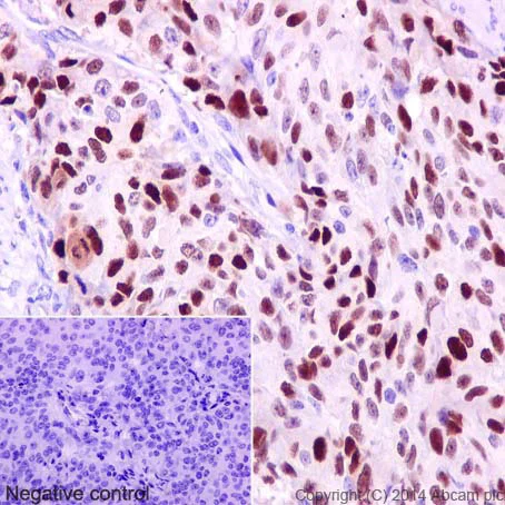 Immunohistochemistry (Formalin/PFA-fixed paraffin-embedded sections) - Anti-Cyclin D1 antibody [EPR2241] - C-terminal (AB134175)