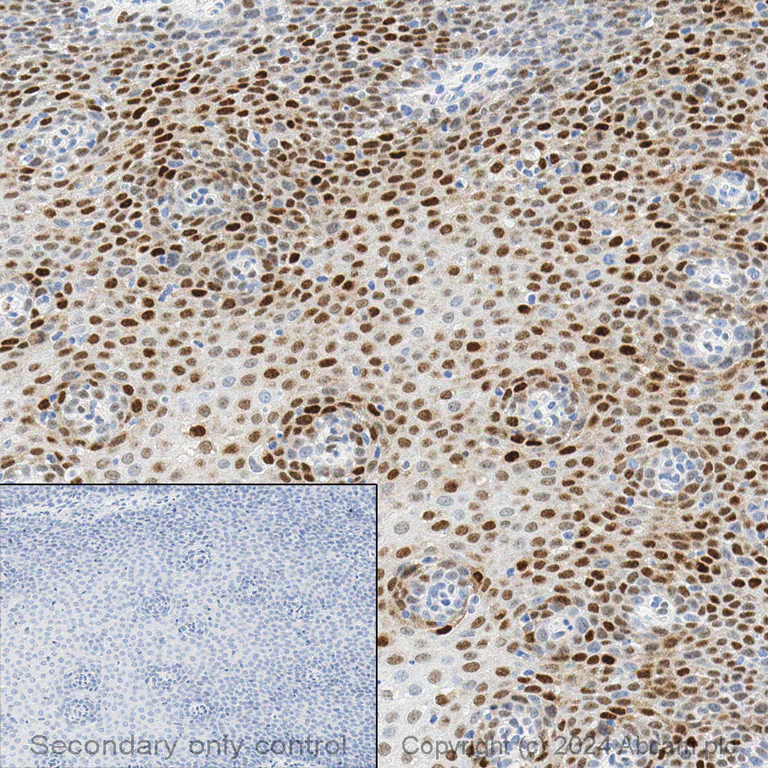 Immunohistochemistry (Formalin/PFA-fixed paraffin-embedded sections) - Anti-Cyclin D1 antibody [EPR2241] - C-terminal (AB134175)
