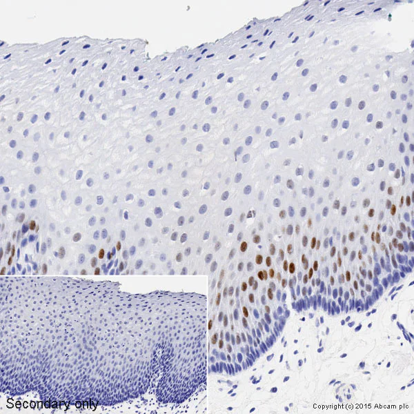 Immunohistochemistry (Formalin/PFA-fixed paraffin-embedded sections) - Anti-Cyclin D1 antibody [EPR2241] - C-terminal (AB134175)