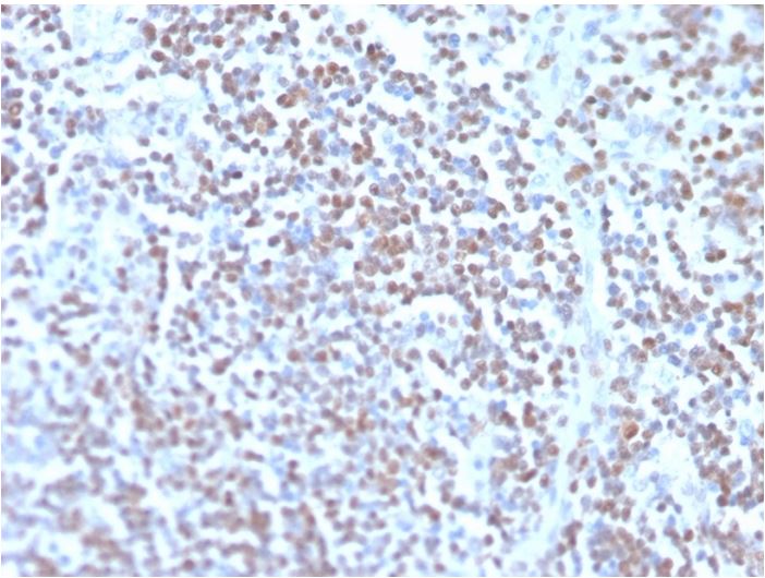 Immunohistochemistry (Formalin/PFA-fixed paraffin-embedded sections) - Anti-Cyclin D1 antibody [rCCND1/4752] (AB273608), expandable thumbnail