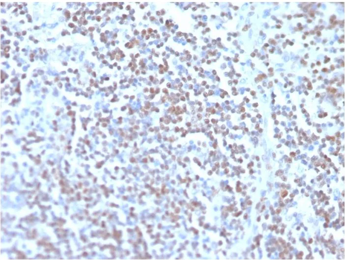 Immunohistochemistry (Formalin/PFA-fixed paraffin-embedded sections) - Anti-Cyclin D1 antibody [rCCND1/4752] - BSA and Azide free (AB273610)
