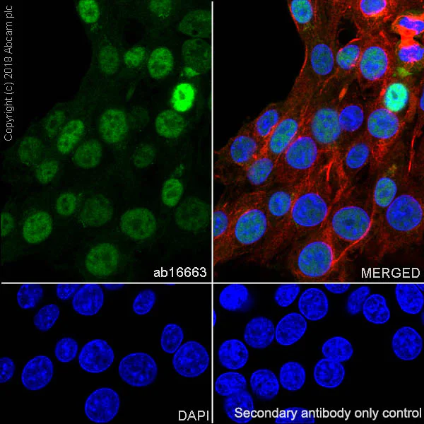 Immunocytochemistry/ Immunofluorescence - Anti-Cyclin D1 antibody [SP4] (AB16663)