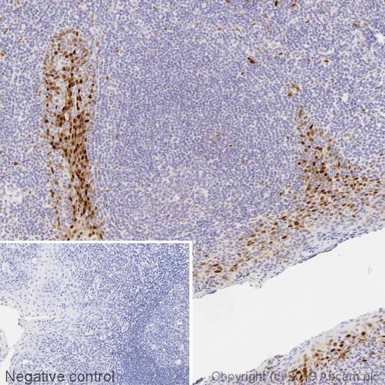 Immunohistochemistry (Formalin/PFA-fixed paraffin-embedded sections) - Anti-Cyclin D1 antibody [SP4] (AB16663)