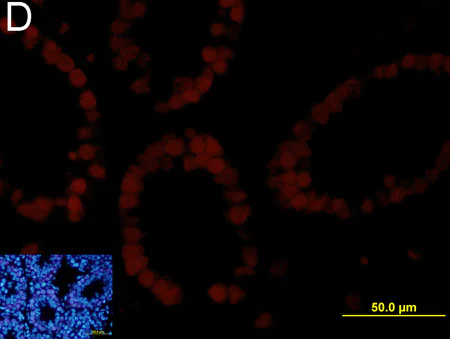 Immunohistochemistry (Formalin/PFA-fixed paraffin-embedded sections) - Anti-Cyclin D1 antibody [SP4] (AB16663)