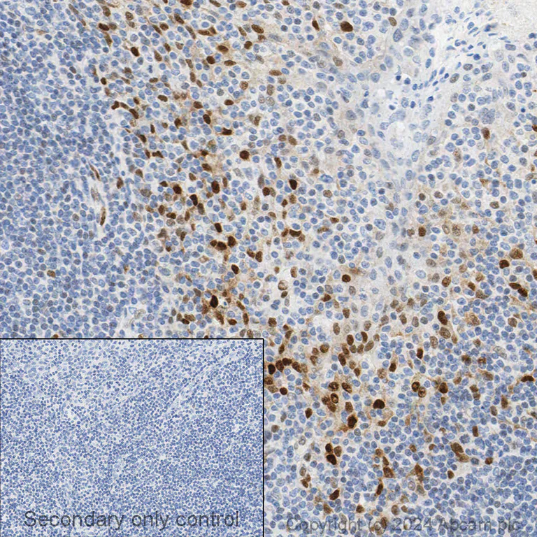 Immunohistochemistry - Anti-Cyclin D1 antibody [SP4] (AB16663)