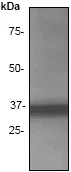Western blot - Anti-Cyclin D1 antibody [SP4] (AB16663)