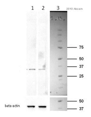 Western blot - Anti-Cyclin D1 antibody [SP4] (AB16663)