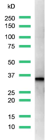 Western blot - Anti-Cyclin D1 antibody [SP4] (AB16663)