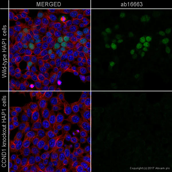 Immunocytochemistry/ Immunofluorescence - Anti-Cyclin D1 antibody [SP4] - BSA and Azide free (AB239794)
