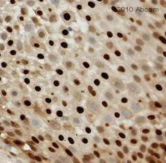 Immunohistochemistry (Formalin/PFA-fixed paraffin-embedded sections) - Anti-Cyclin D1 antibody [SP4] - BSA and Azide free (AB239794)