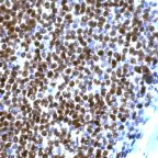 Immunohistochemistry (Formalin/PFA-fixed paraffin-embedded sections) - Anti-Cyclin D1 antibody [SP4] - BSA and Azide free (AB239794)