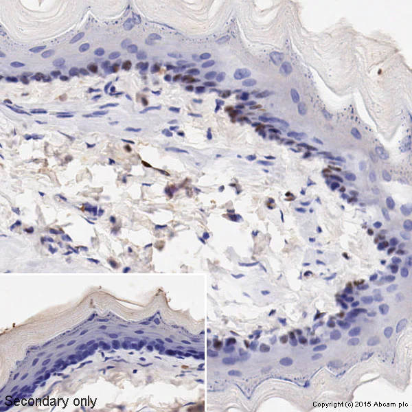 Immunohistochemistry (Formalin/PFA-fixed paraffin-embedded sections) - Anti-Cyclin D1 antibody [SP4] - BSA and Azide free (AB239794)