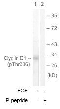 Western blot - Anti-Cyclin D1 (phospho T286) antibody (AB62151)